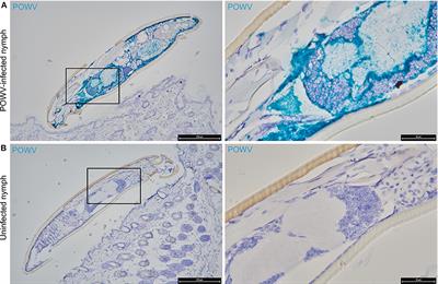 Utilization of RNA in situ Hybridization to Understand the Cellular Localization of Powassan Virus RNA at the Tick-Virus-Host Interface